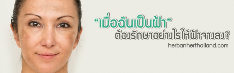 “เมื่อฉันเป็นฝ้า” ต้องรักษาอย่างไรให้ฝ้าจางลง?
